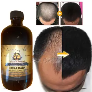 Castor Oil { General Hair Growth Product]