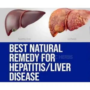 Best Natural Remedy for Hepatitis/ Liver/Kidney Disease