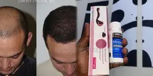 Hair Growth-Kirkland Minoxidil for Baldness Growth