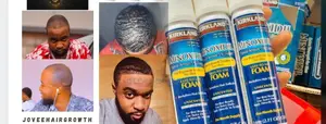 Kirkland Minoxidil Foam for Hair and Baldness Growth
