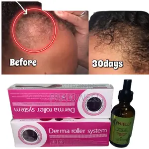 Mielle Derma Roller for Perfect Hair Growth