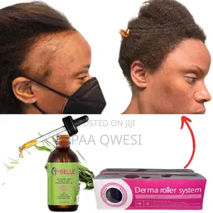 {Mielle Derma Roller} Super Hairline Loss Regrowth