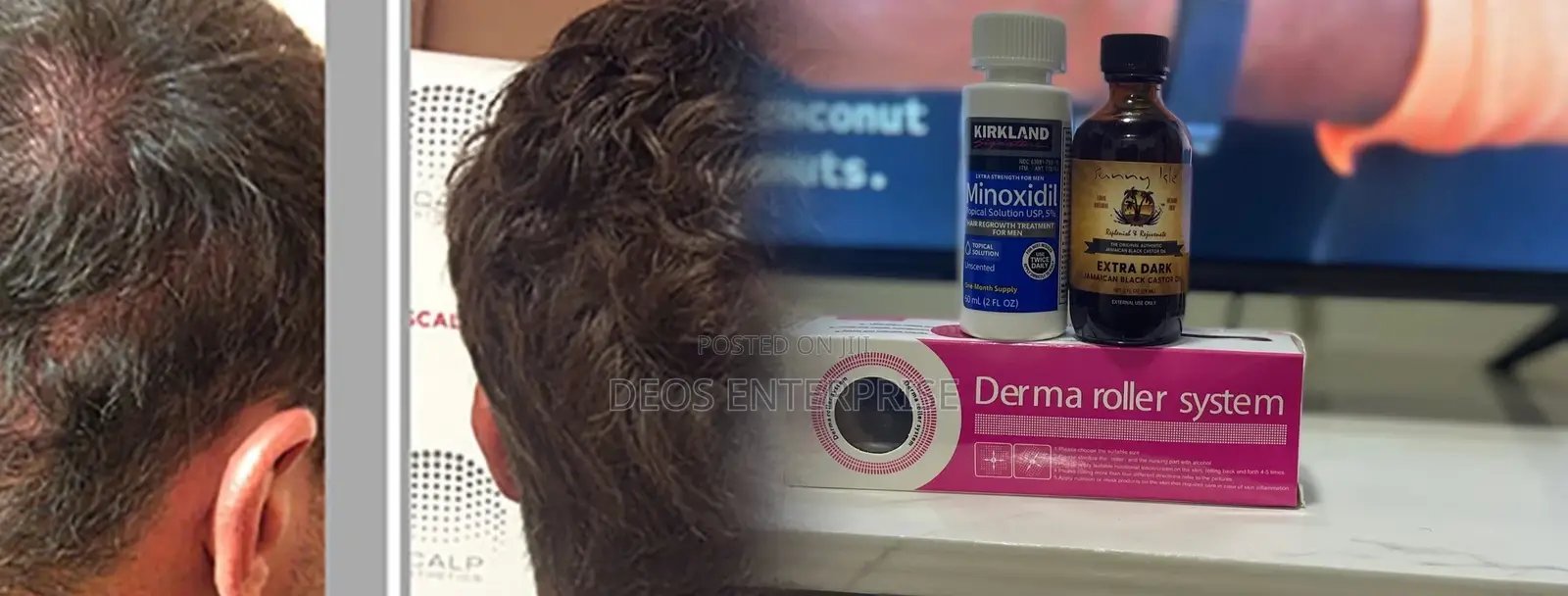 Massive Kirkland Roller Castor Oil for Hair Growth