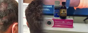 Massive Kirkland Roller Castor Oil for Hair Growth