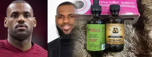 Mielle Castor Oil Derma Roller Best for Beard Growth