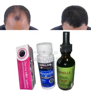 Roller , Kirkland Mielle for Hair Loss Regrowth