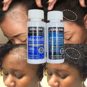 Two Kirkland Minoxidil for Hair Growth for Sale