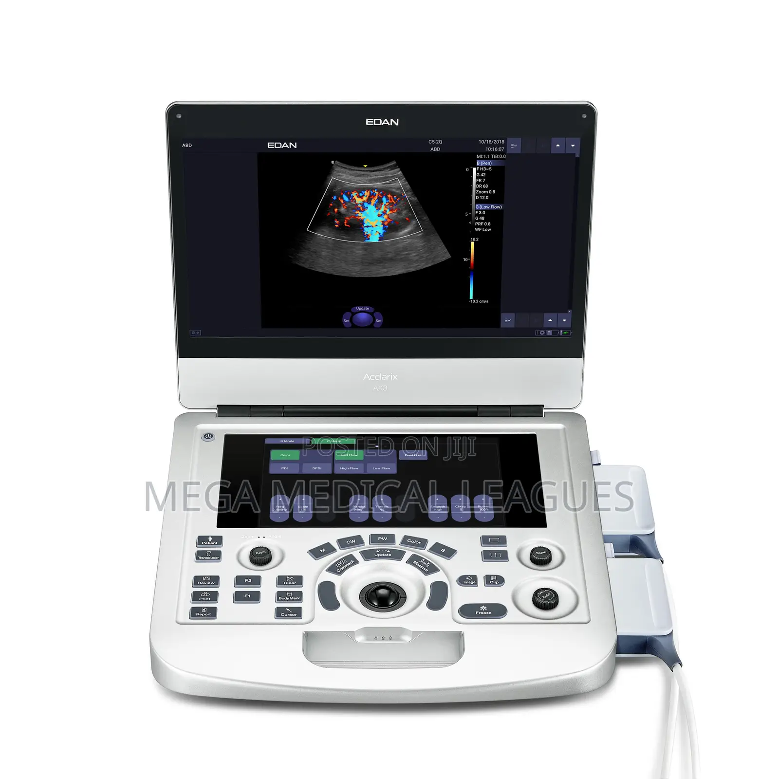 Edan AX3 Ultrasound Portable, 4D Ultrasound