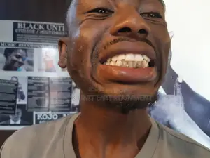 Teeth Whitening Studio