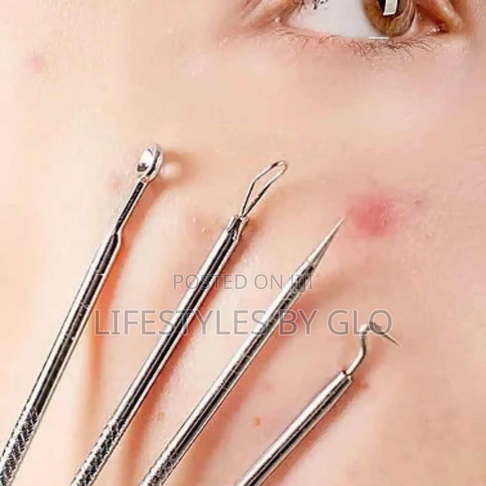 Stainless Steel 4pc Facial Extractor Kit Acne Blemish