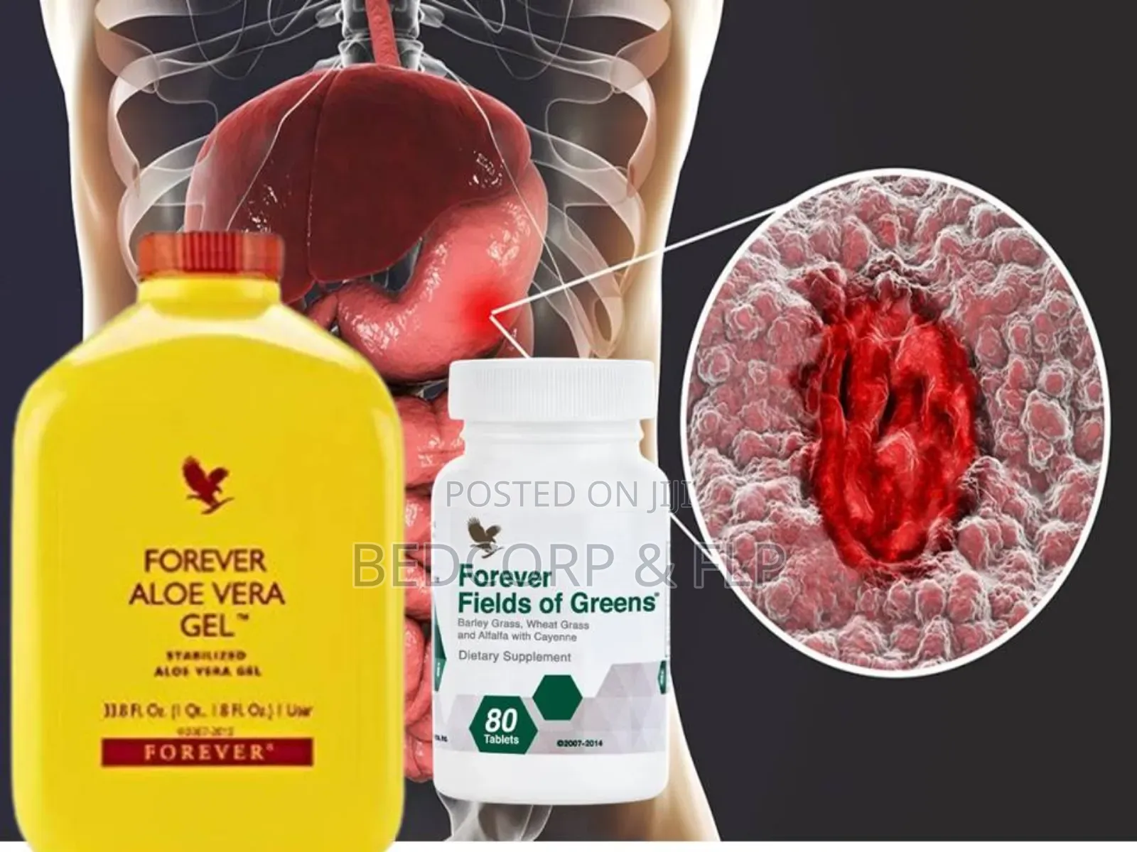 Natural Ulcer Remedy Pack