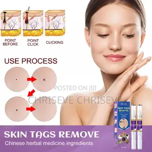 Super Active Skin Wart Remover