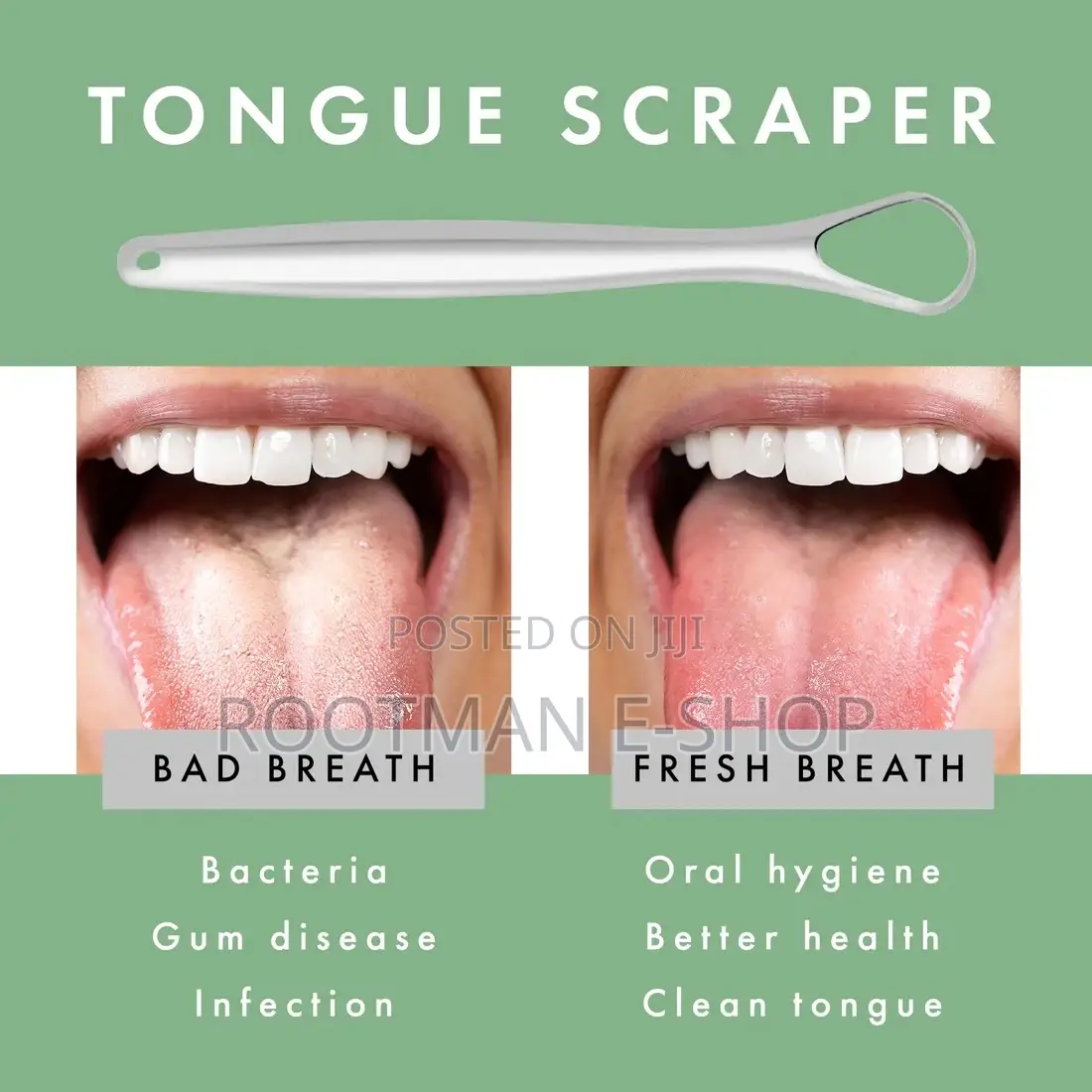 3 PCS Metal Tongue Scraper, Tongue Scrapers For Adults