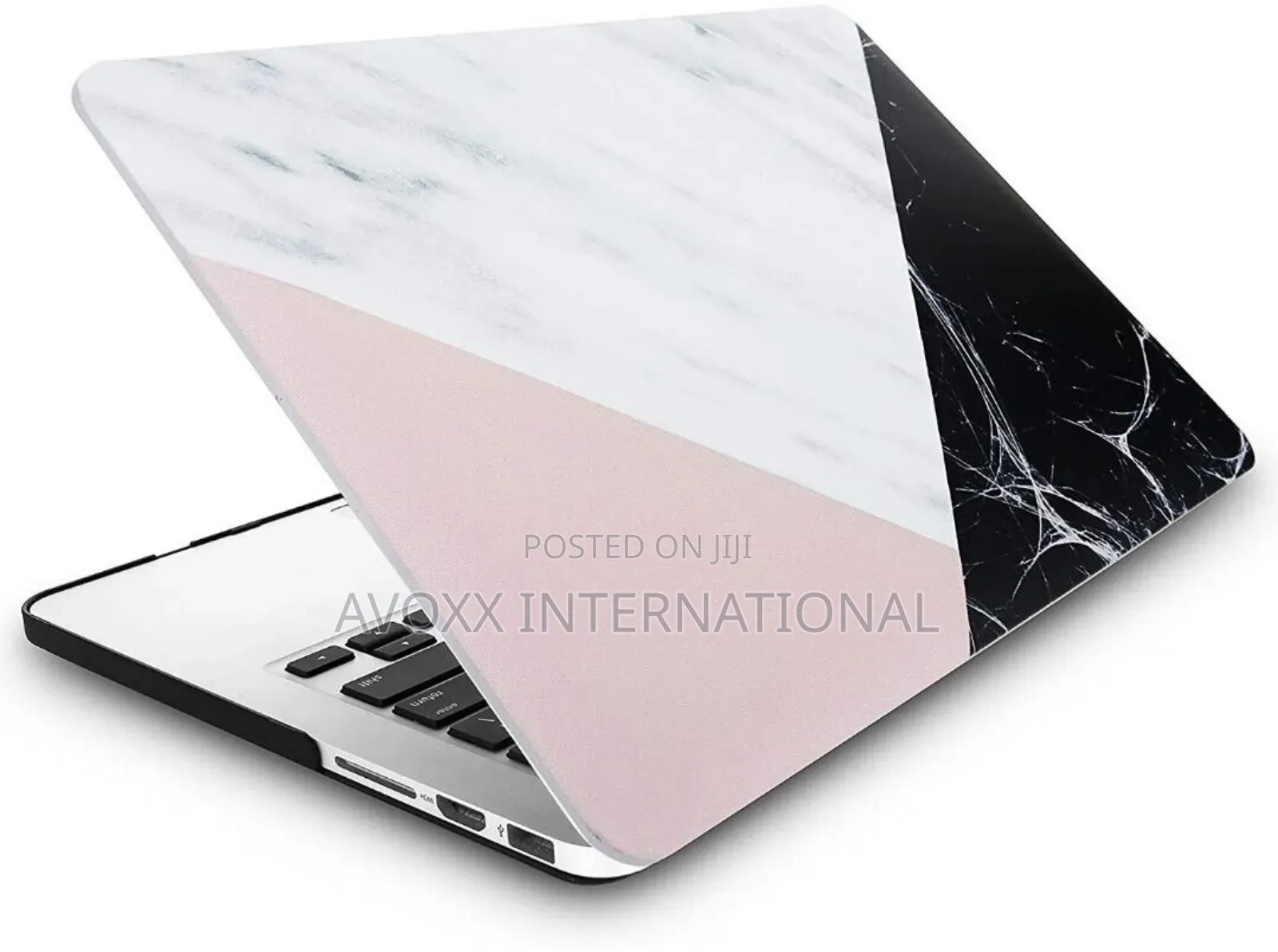 KECC 5 in 1 Bundle Case for Macbook Air 13" A1502/A1425