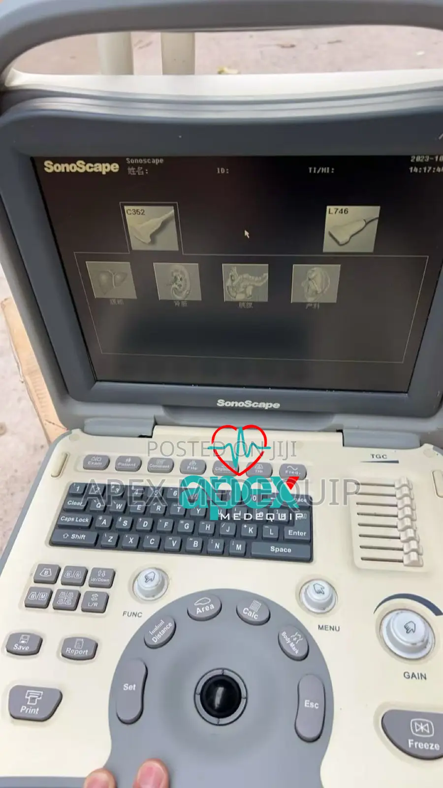 Sonoscape A6 Portable Ultrasound Machine + 2 Probes