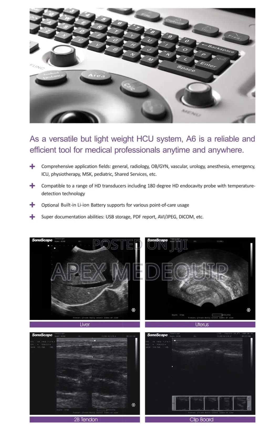 Sonoscape A6 Portable Ultrasound Machine + 2 Probes