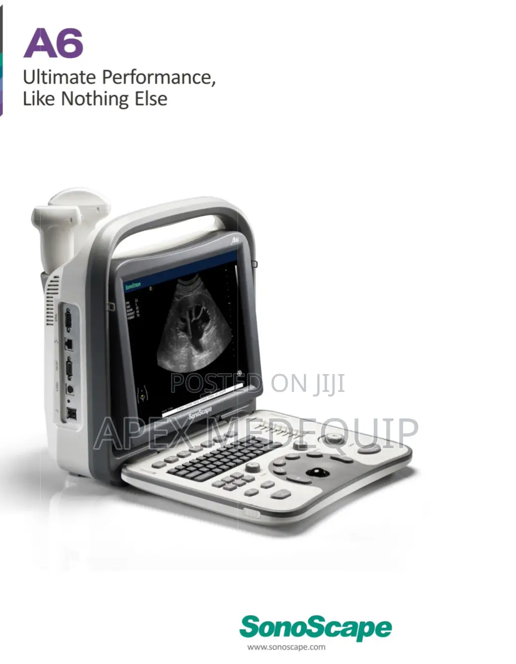 Sonoscape A6 Portable Ultrasound Machine + 2 Probes