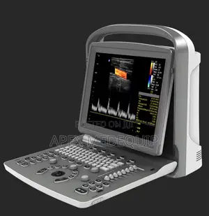 Chison Eco 2 Portable Doppler Ultrasound + Battery
