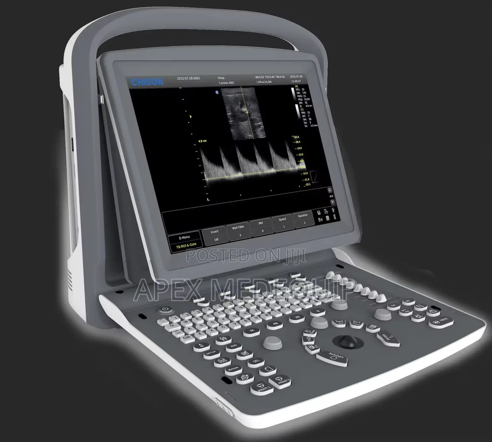 Portable Doppler Ultrasound Machine + 1 Probe (Chison Eco 2)