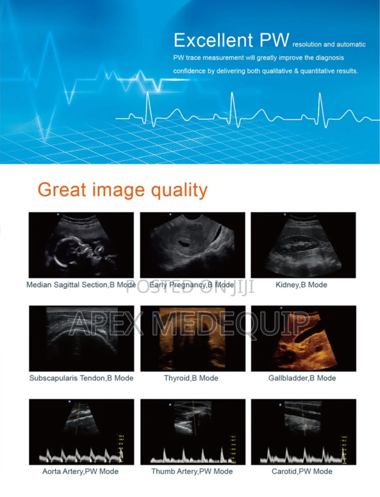 Portable Doppler Ultrasound Machine + 1 Probe (Chison Eco 2)