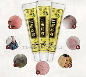 Psoriasis and Eczema Cream