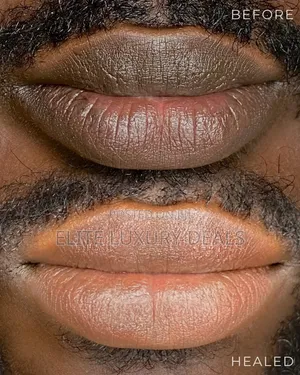 Permanent Lips Tattoo