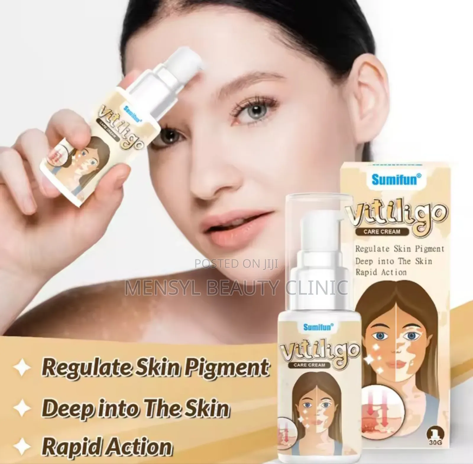Vitiligo Spray Treatment, and White Spots on Skin