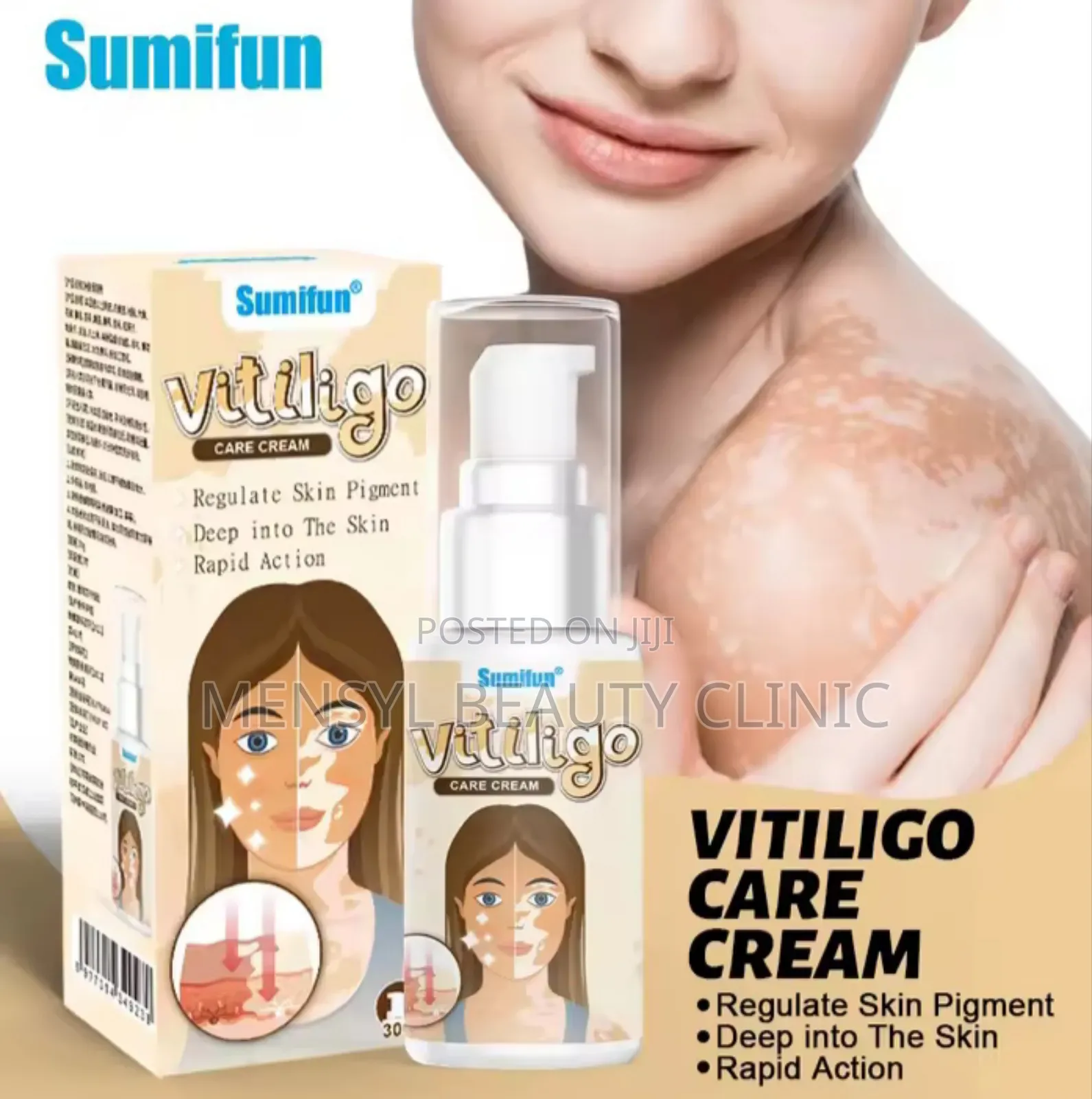 Vitiligo Spray Treatment, and White Spots on Skin