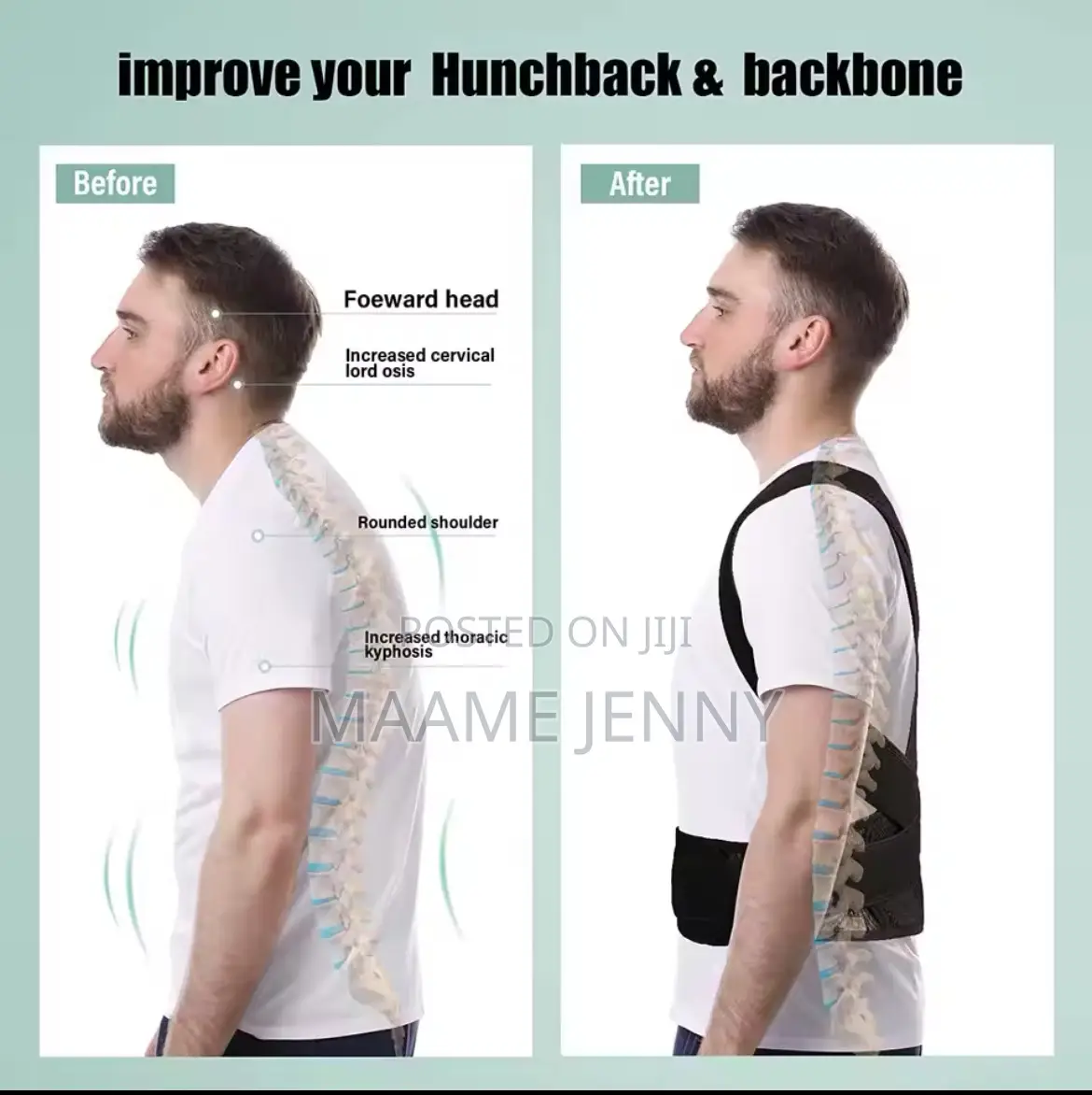 Posture Corrector