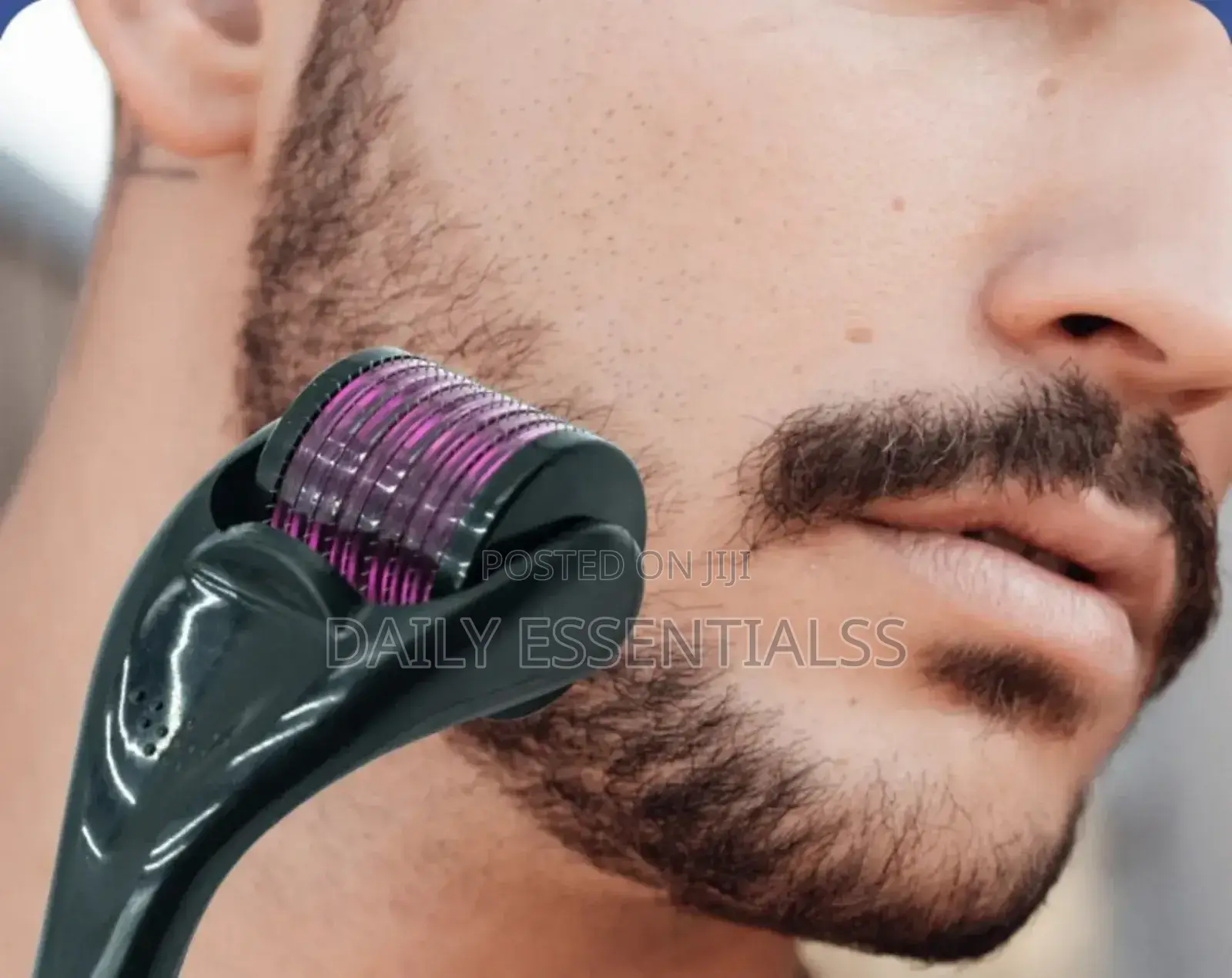 Liquid Power for Balding Spots – Kirkland Minoxidil