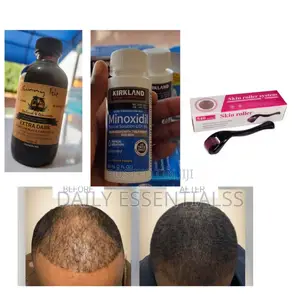 Full Hair Regrowth Combo Pack