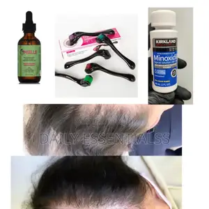 Kirkland X Mielle X Derma Roller Growth Combo