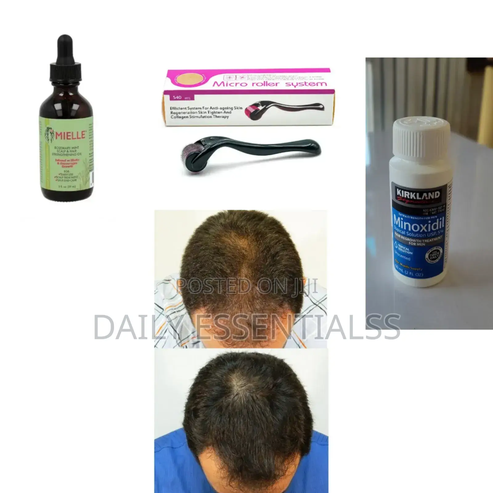 3-Step Hair Beard Growth – Mielle, Kirkland Roller