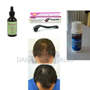 3-Step Hair Beard Growth – Mielle, Kirkland Roller