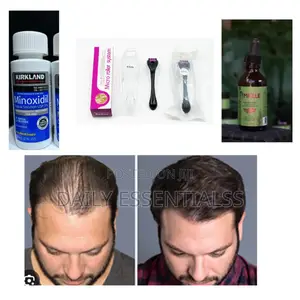 Bald Spots Patchy Beard Solution