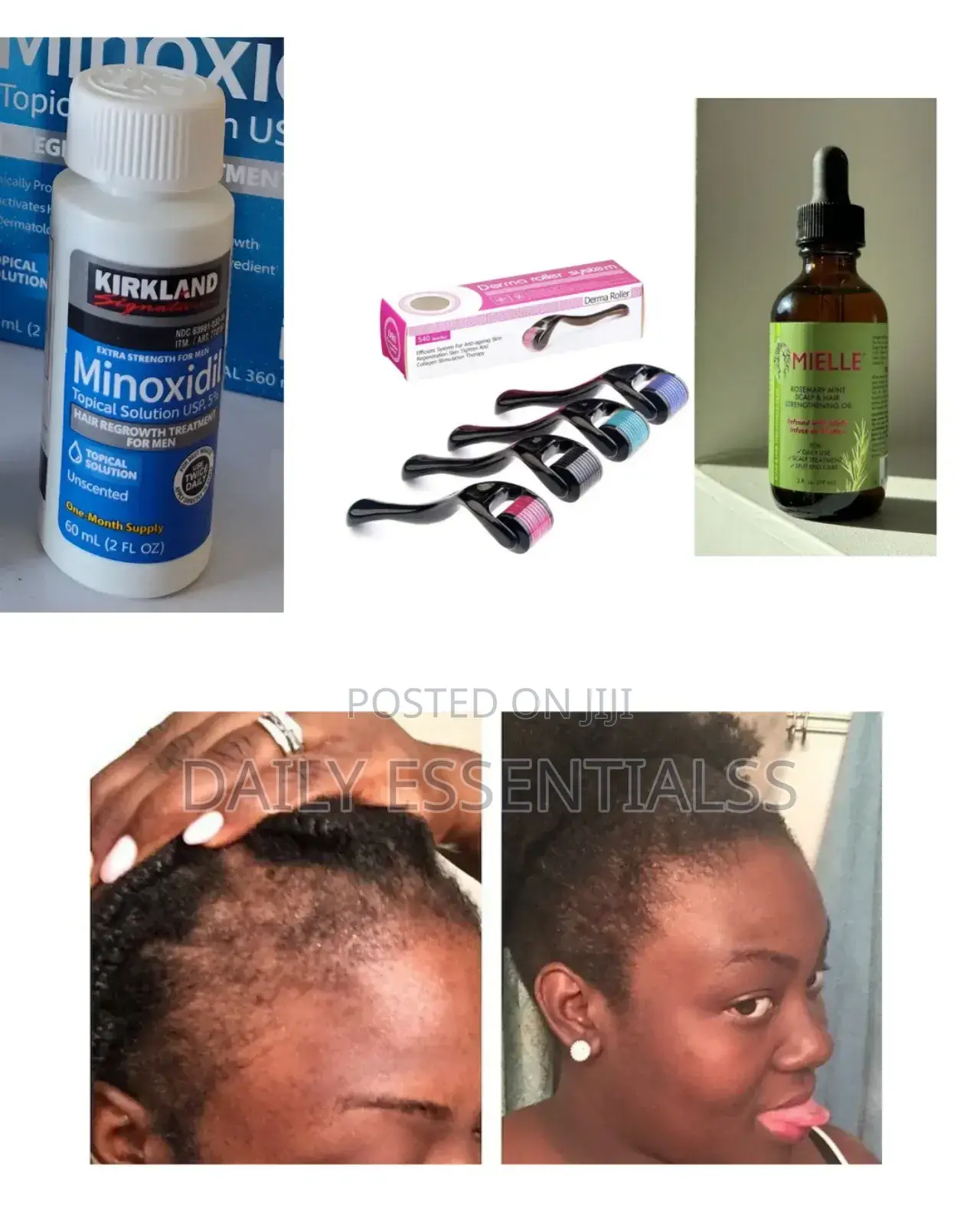 Beard Hair Growth System That Works