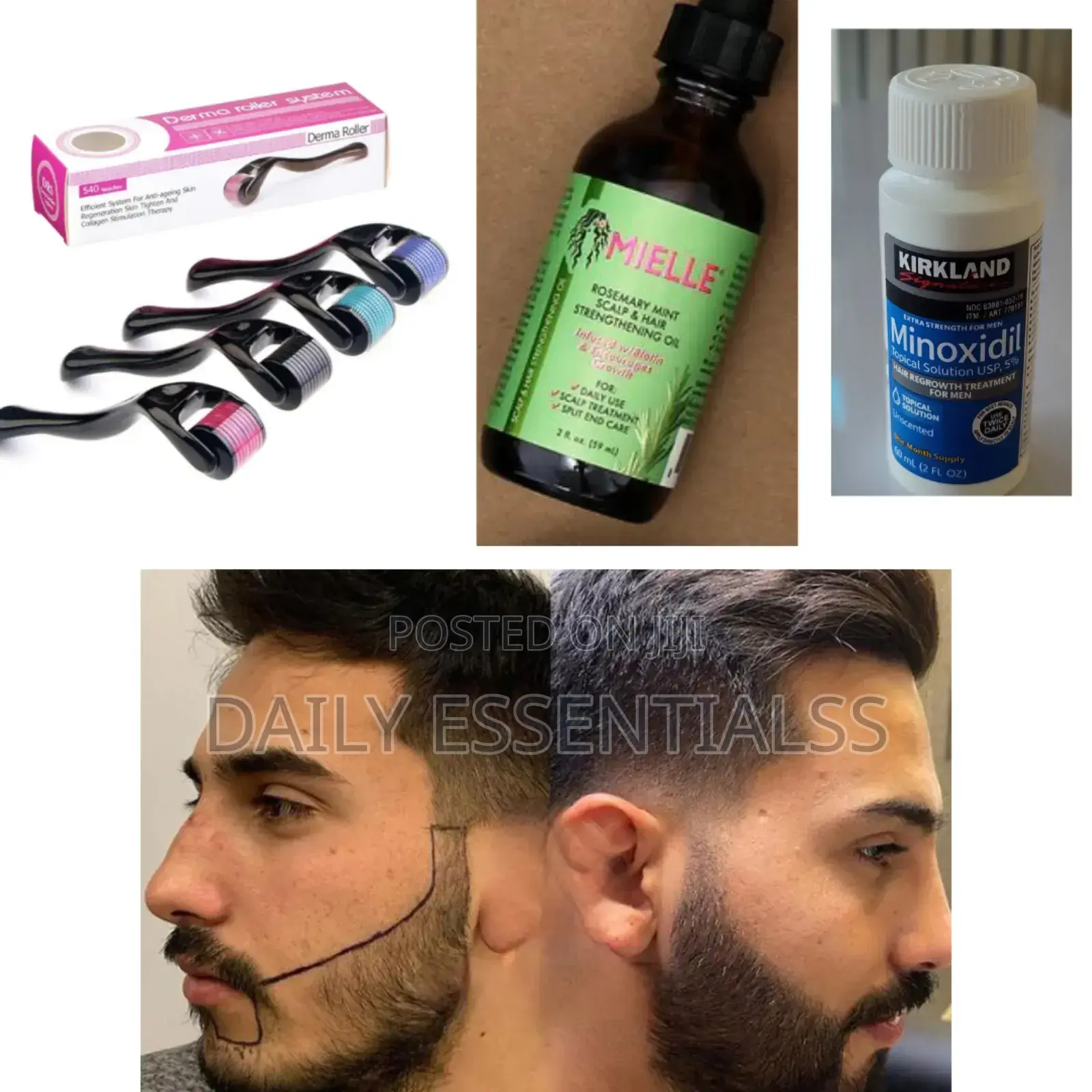 Kirkland, Derma Roller Mielle Combo :The Hair Revival Set