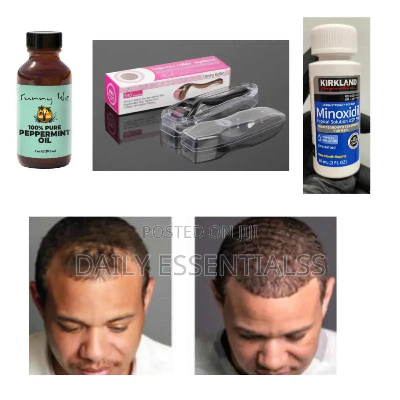 Kirkland, Peppermint Derma Roller Combo