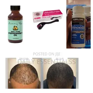 Kirkland, Peppermint Oil Derma Roller Growth Set