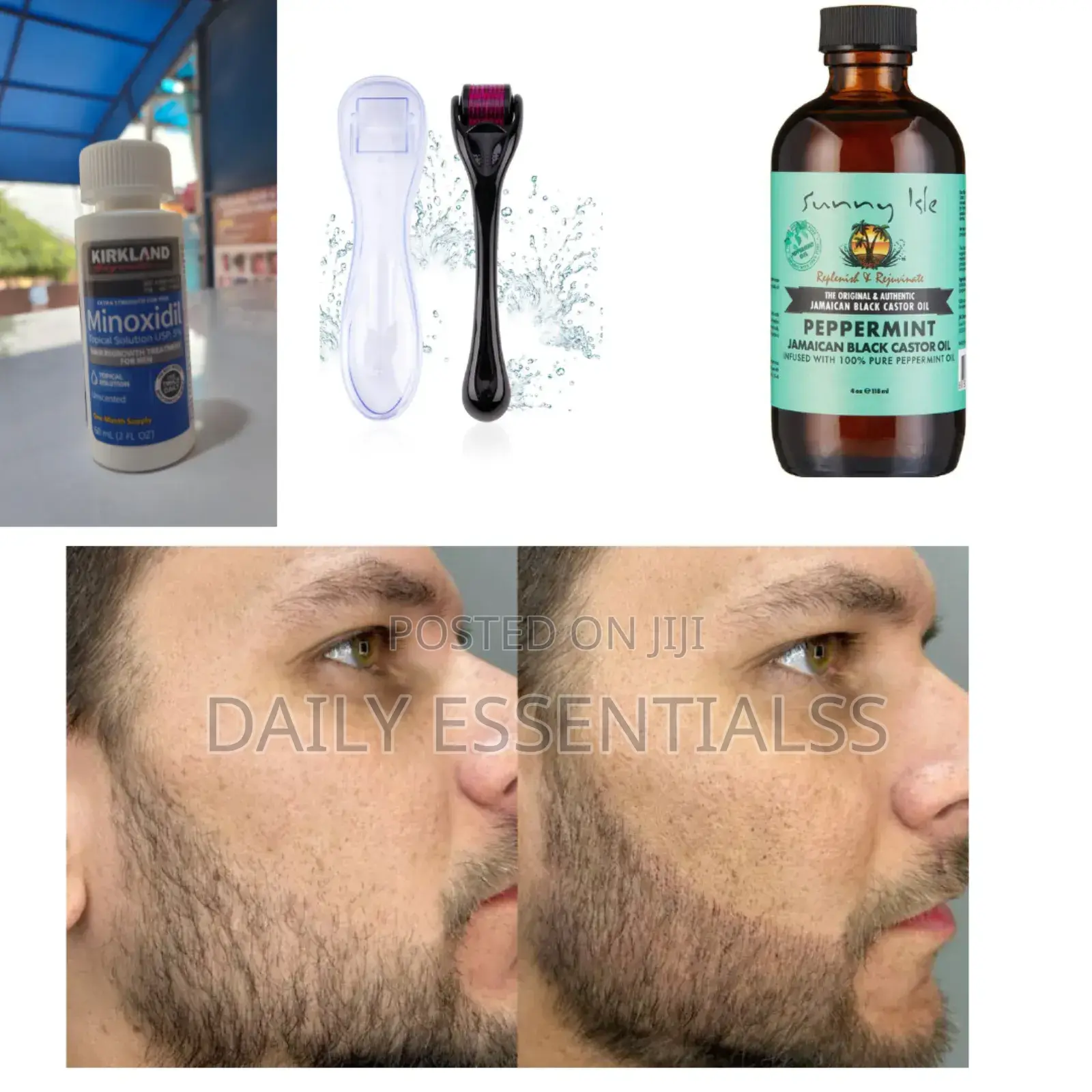 Derma Roller, Kirkland Peppermint Oil Hair Boost Trio