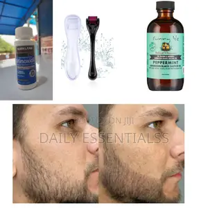 Derma Roller, Kirkland Peppermint Oil Hair Boost Trio