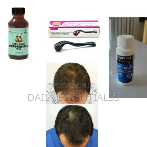 Kirkland+ Derma Roller +Peppermint Oil Hair Beard Booster