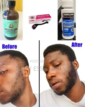 Kirkland + Peppermint Oil + Derma Roller Beard Hair Builder
