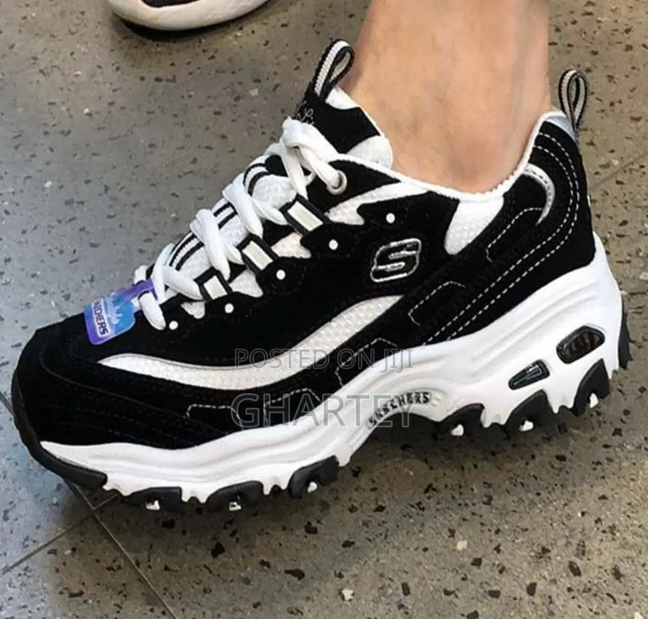 Sketchers Luxury Fashion Black White Sneakers