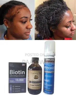Triple Boost Hair Growth Set- Biotin + Foam + Chebe