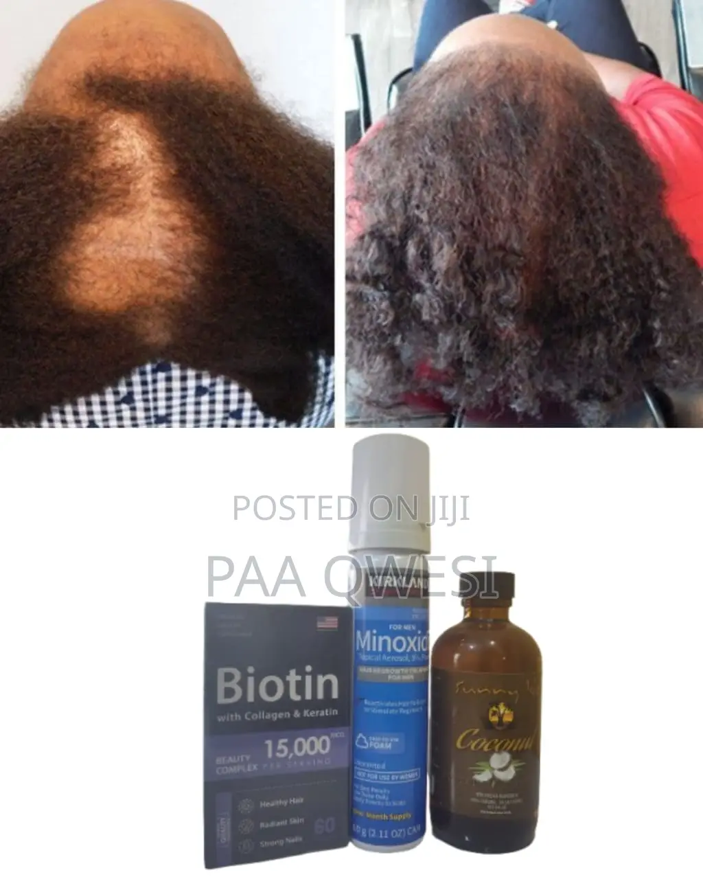 Full Hair Growth Trio - Biotin + Coconut + Foam