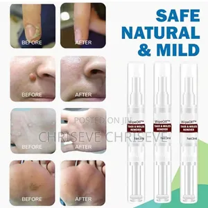 Super Active Skin Wart Remover