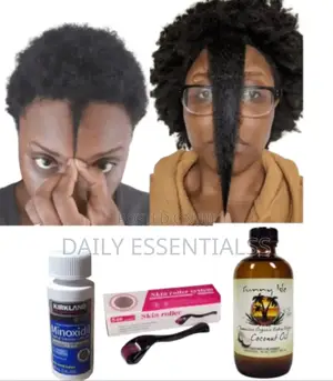 Minoxidil, Roller Sunny Isle Coconut Oil Combo