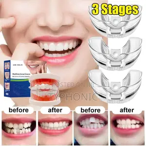 Teeth Corrector, Anti Snoring Device