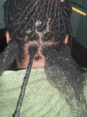 Dreadlock Unlocking